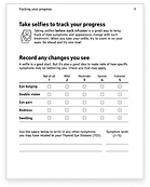 Cover image of the TEPEZZA Treatment Tracker document